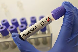 Počet nových případů žloutenky A v Praze třetí týden v řadě klesl - Seznam Zprávy